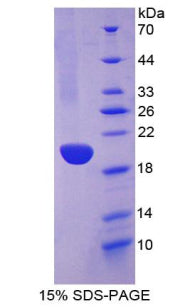 Figure 1. SDS-PAGE