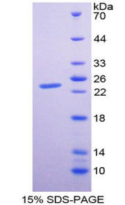 Figure 1. SDS-PAGE