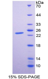 Figure 1. SDS-PAGE