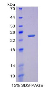 Figure 1. SDS-PAGE