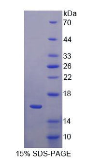Figure 1. SDS-PAGE