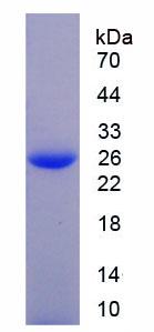 Figure 3. SDS-PAGE