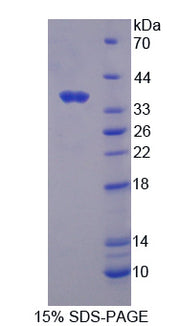 Figure 1. SDS-PAGE
