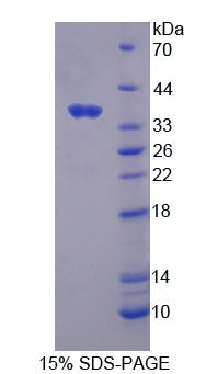 Figure 1. SDS-PAGE