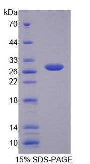 Figure 1. SDS-PAGE