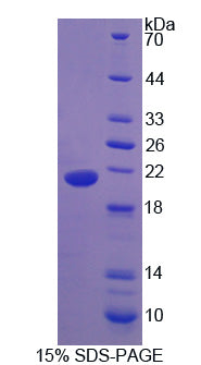 Figure 1. SDS-PAGE