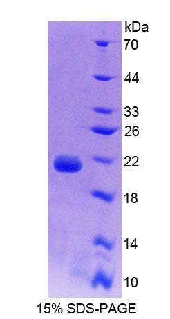 Figure 1. SDS-PAGE