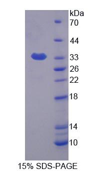 Figure 1. SDS-PAGE