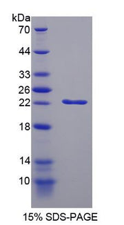 Figure 1. SDS-PAGE