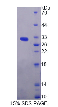 Figure 1. SDS-PAGE