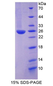 Figure 1. SDS-PAGE