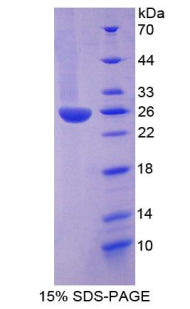 Figure 1. SDS-PAGE