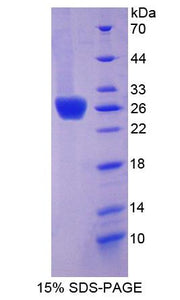 Figure 1. SDS-PAGE