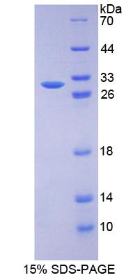 Figure 1. SDS-PAGE