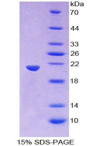 Figure 1. SDS-PAGE