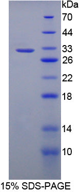 Figure 1. SDS-PAGE