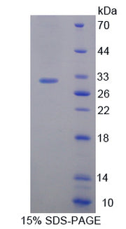 Figure 1. SDS-PAGE