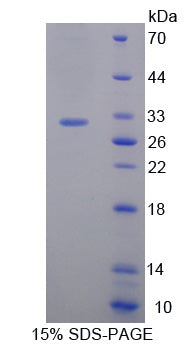 Figure 1. SDS-PAGE