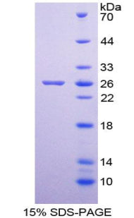 Figure 1. SDS-PAGE