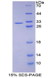 Figure 1. SDS-PAGE