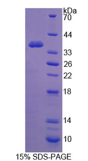 Figure 1. SDS-PAGE