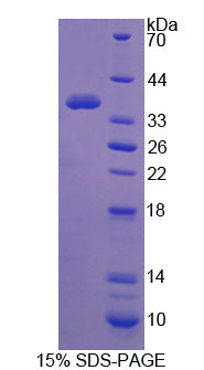 Figure 1. SDS-PAGE
