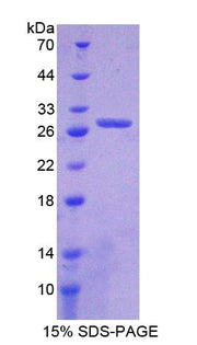 Figure 1. SDS-PAGE