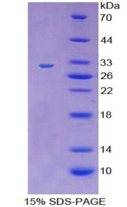 Figure 1. SDS-PAGE
