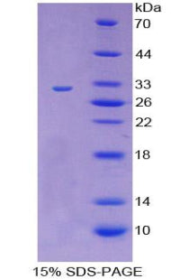 Figure 1. SDS-PAGE