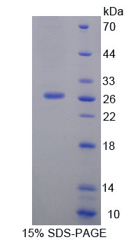 Figure 1. SDS-PAGE
