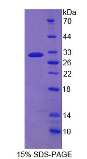 Figure 1. SDS-PAGE