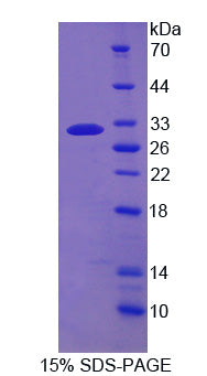 Figure 1. SDS-PAGE