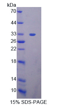 Figure 1. SDS-PAGE