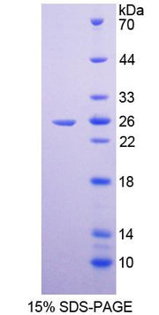 Figure 1. SDS-PAGE