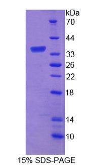 Figure 1. SDS-PAGE