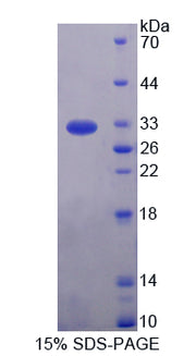 Figure 1. SDS-PAGE