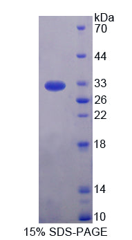 Figure 1. SDS-PAGE