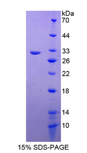 Figure 1. SDS-PAGE