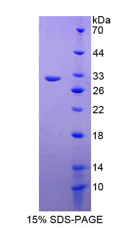 Figure 1. SDS-PAGE