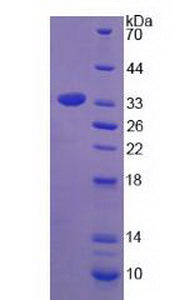 Figure 3. SDS-PAGE