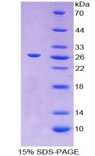 Figure 1. SDS-PAGE
