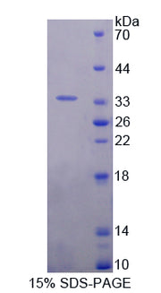 Figure 1. SDS-PAGE