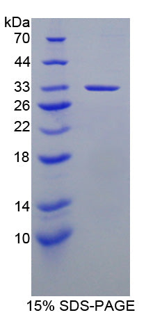 Figure 1. SDS-PAGE