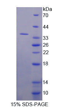 Figure 1. SDS-PAGE