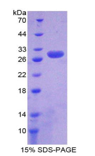 Figure 1. SDS-PAGE