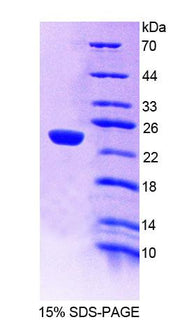 Figure 1. SDS-PAGE