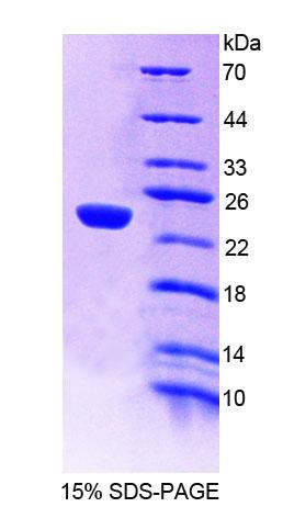 Figure 1. SDS-PAGE