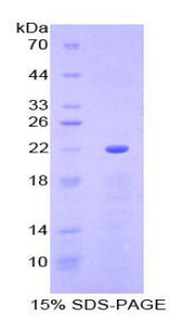 Figure 1. SDS-PAGE