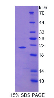 Figure 1. SDS-PAGE