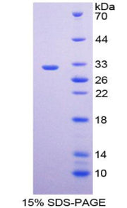 Figure 1. SDS-PAGE